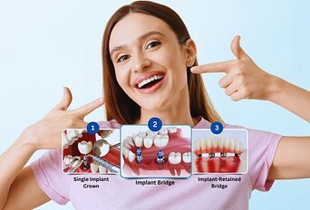 Dentures vs Implants: A Comprehensive Guide for Patients in Dearborn, MI