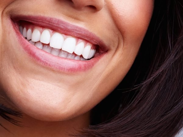 Teeth Whitening in Dearborn