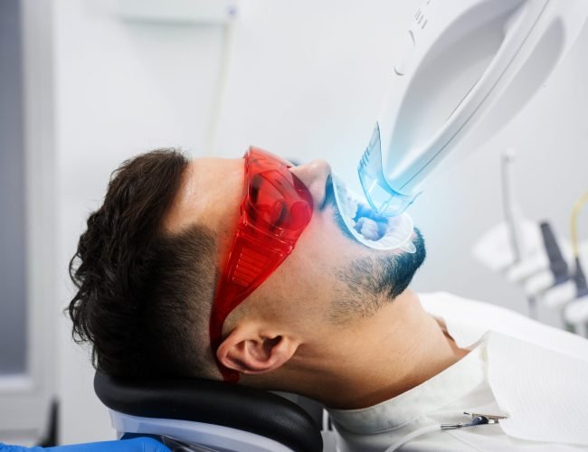 Patient,Whitens,His,Teeth,While,Treatment,In,Dental,Cabinet.,Ultraviolet